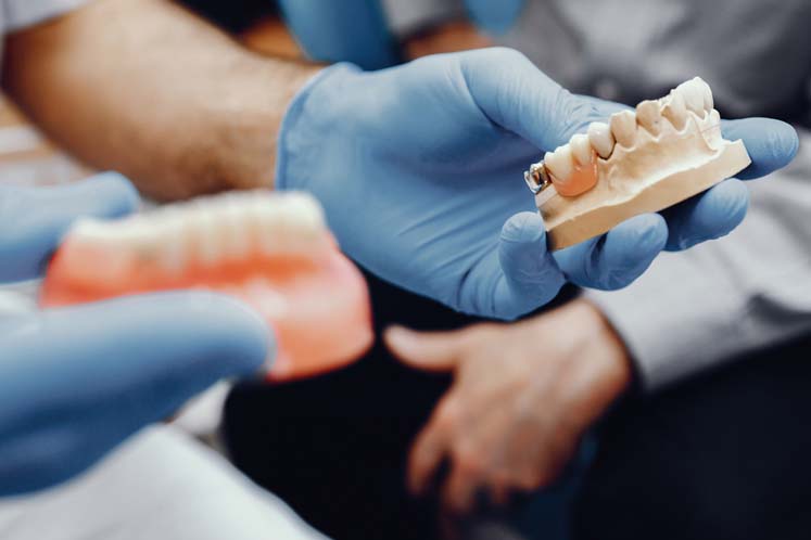 overkappingsprothese